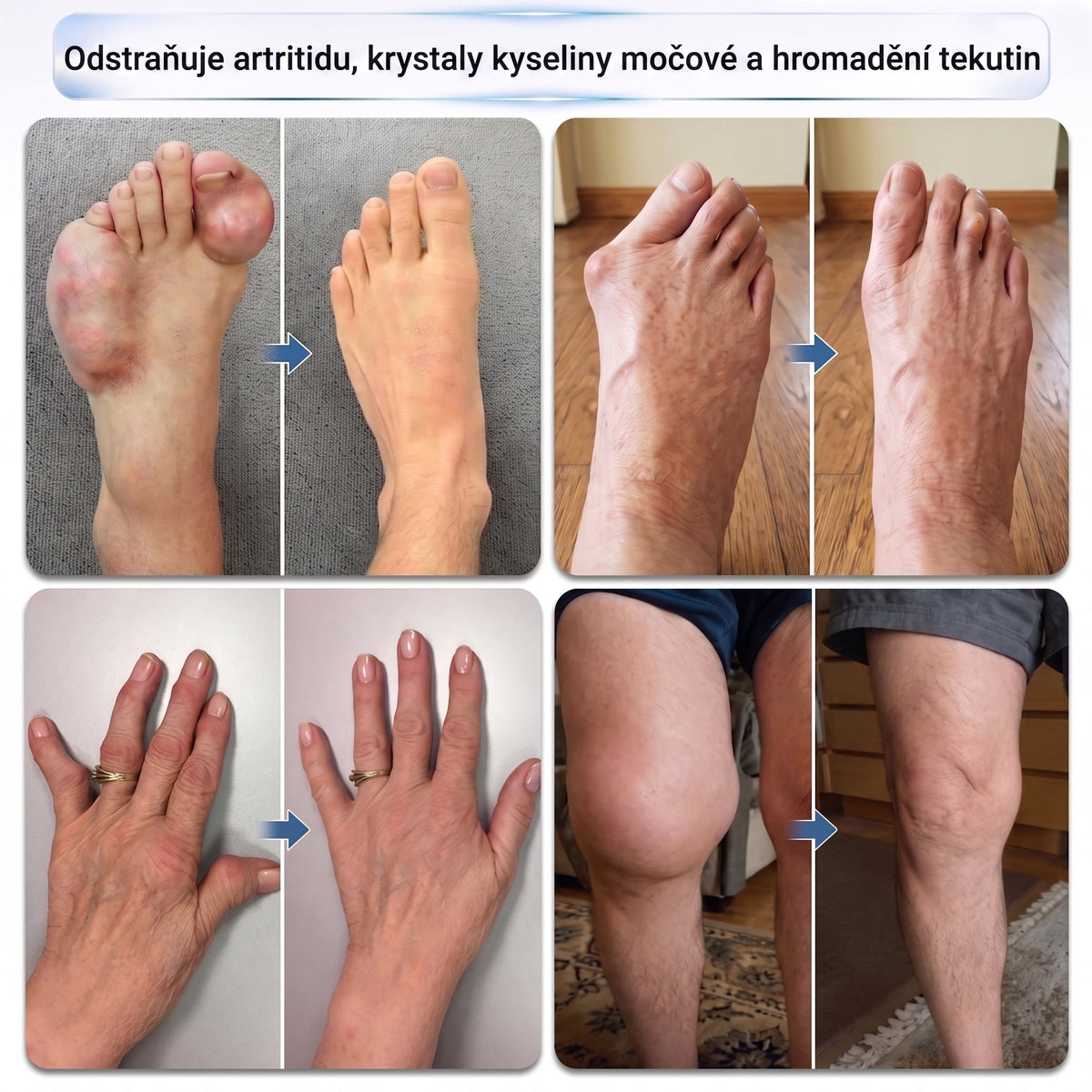 XRLXRL®🪄 TECHNOLOGIE ORTOPEDICKÉ REGENERACE NOVÉ GENERACE · 0,05mm mikrojehličkový váleček pro obnovu kostí a kloubů