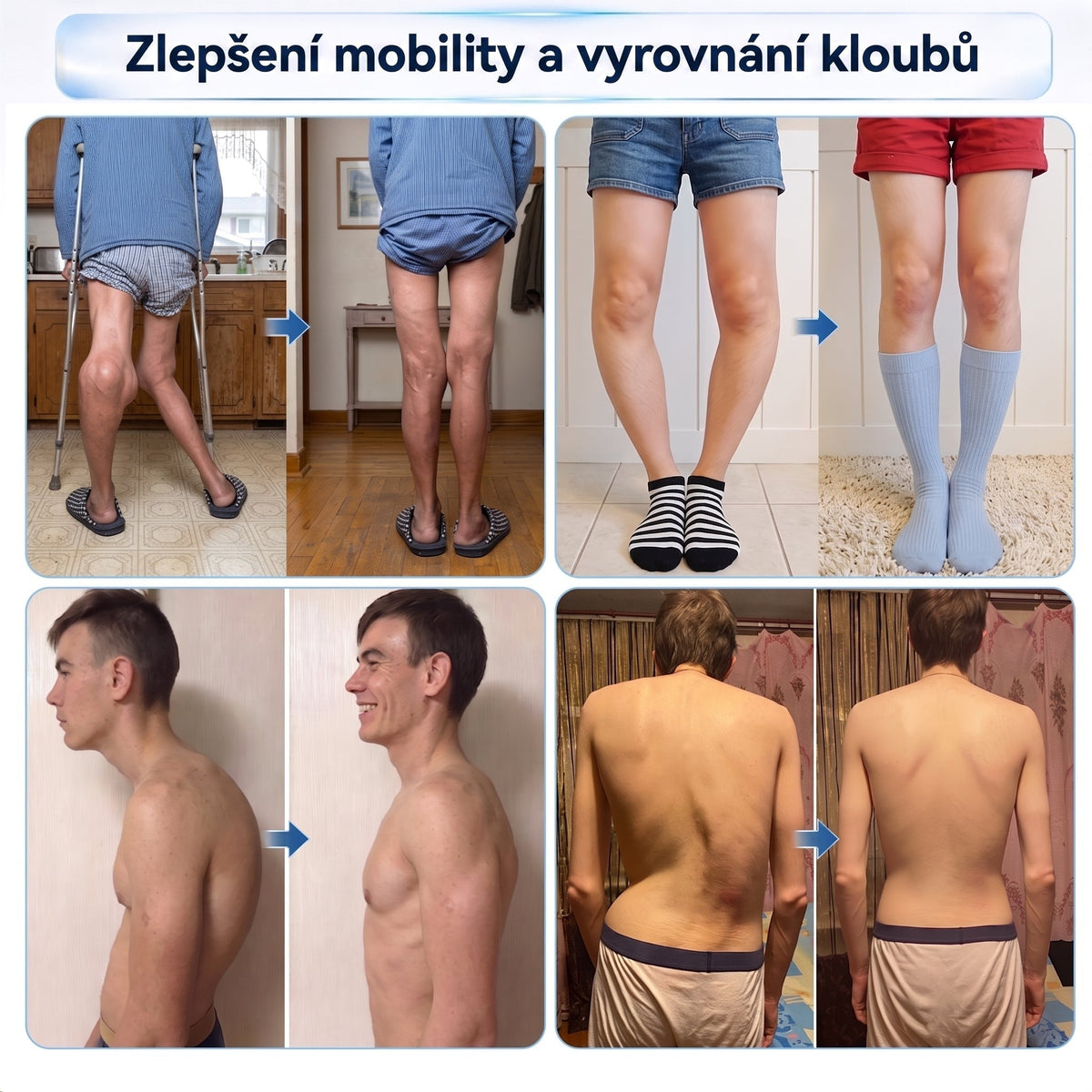 XRLXRL®🪄 TECHNOLOGIE ORTOPEDICKÉ REGENERACE NOVÉ GENERACE · 0,05mm mikrojehličkový váleček pro obnovu kostí a kloubů